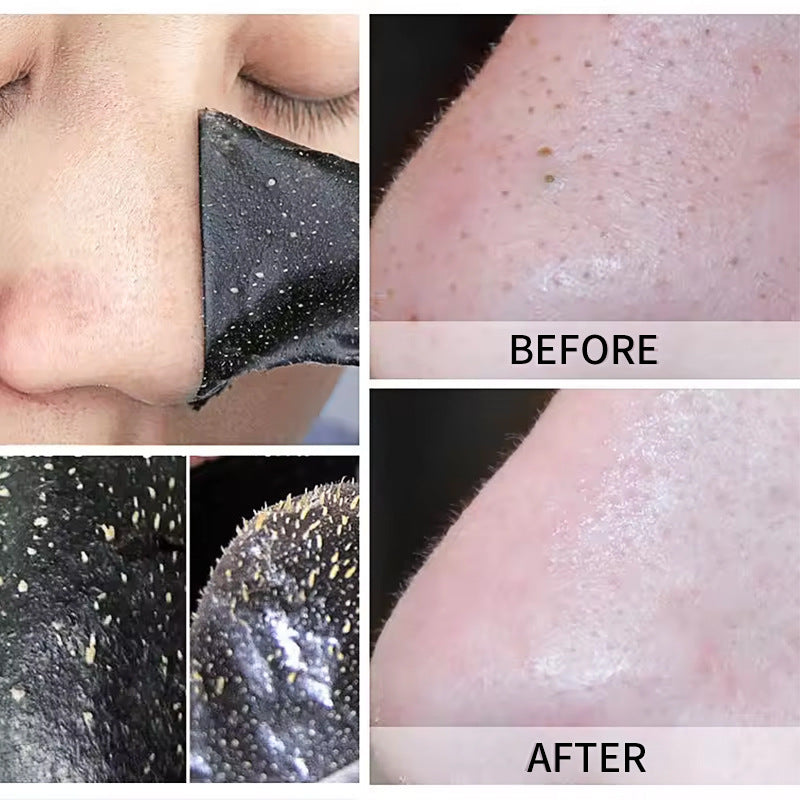 Clean Pores Blackhead Acne Skin Care Products