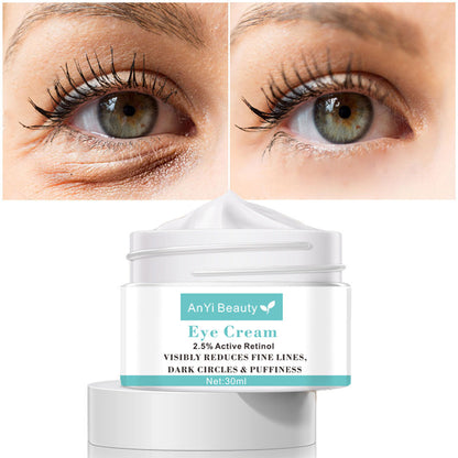 Best eye cream for dark circles clinique eye cream