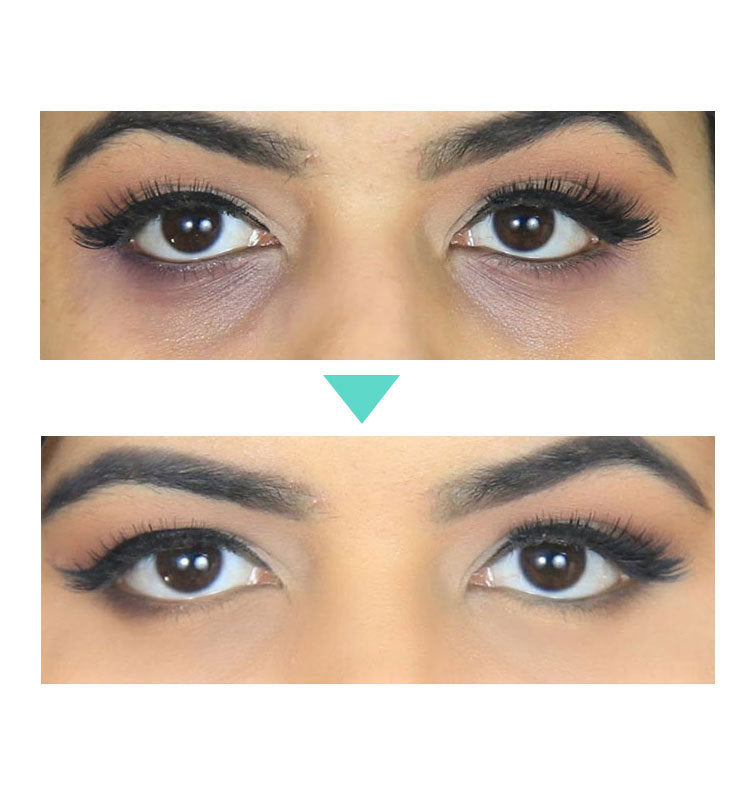 Best eye cream for dark circles clinique eye cream