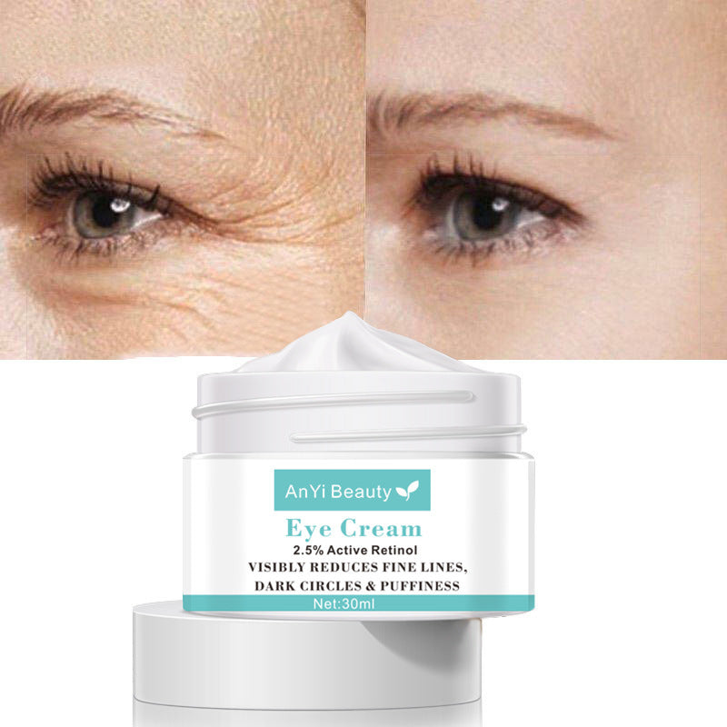Best eye cream for dark circles clinique eye cream