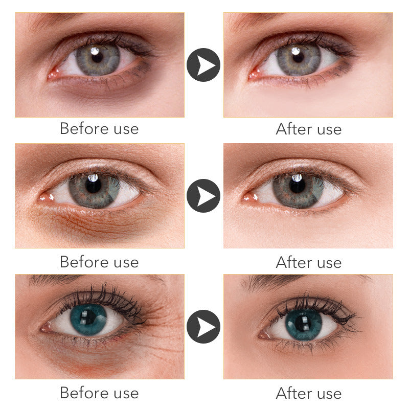Best eye cream for dark circles clinique eye cream